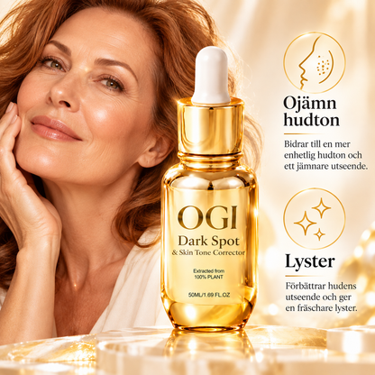 Dark Spot Correcting Serum – Ansiktsserum med 10% Niacinamid, 4% Tranexamsyra & 2% Arbutin – 50 ml
